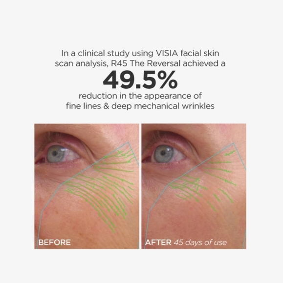 NIB $160 BeautyBio R45 The Reversal 3-Phase Retinol Booster System - Picture 5 of 11